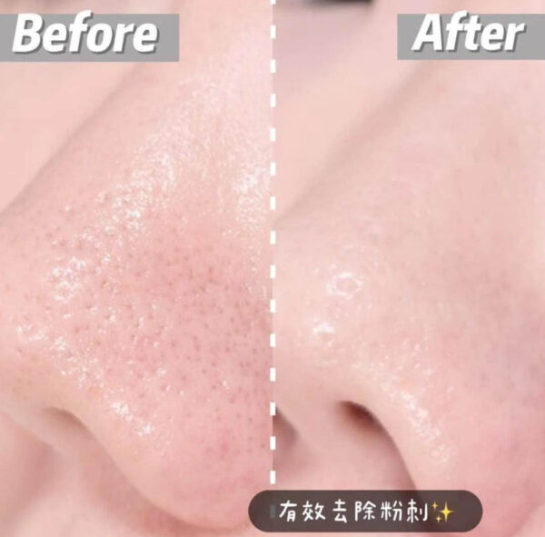 AClean Gel - Imagen 3