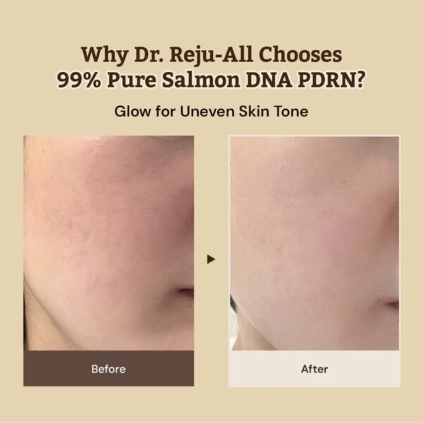 Dr. Reju-All PD3 Advanced PDRN Cream 20ml - Imagen 5